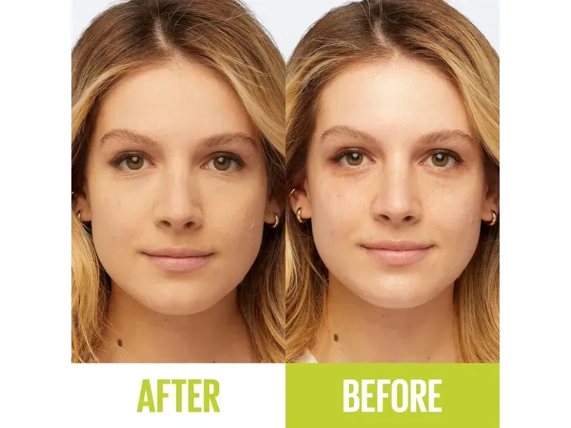 000000000075234403-UN-06