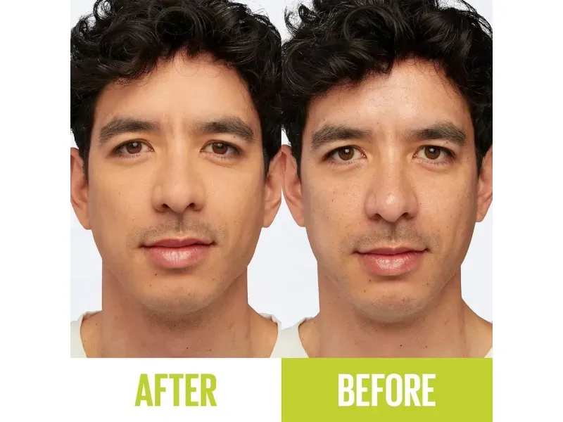 000000000075233494-UN-06